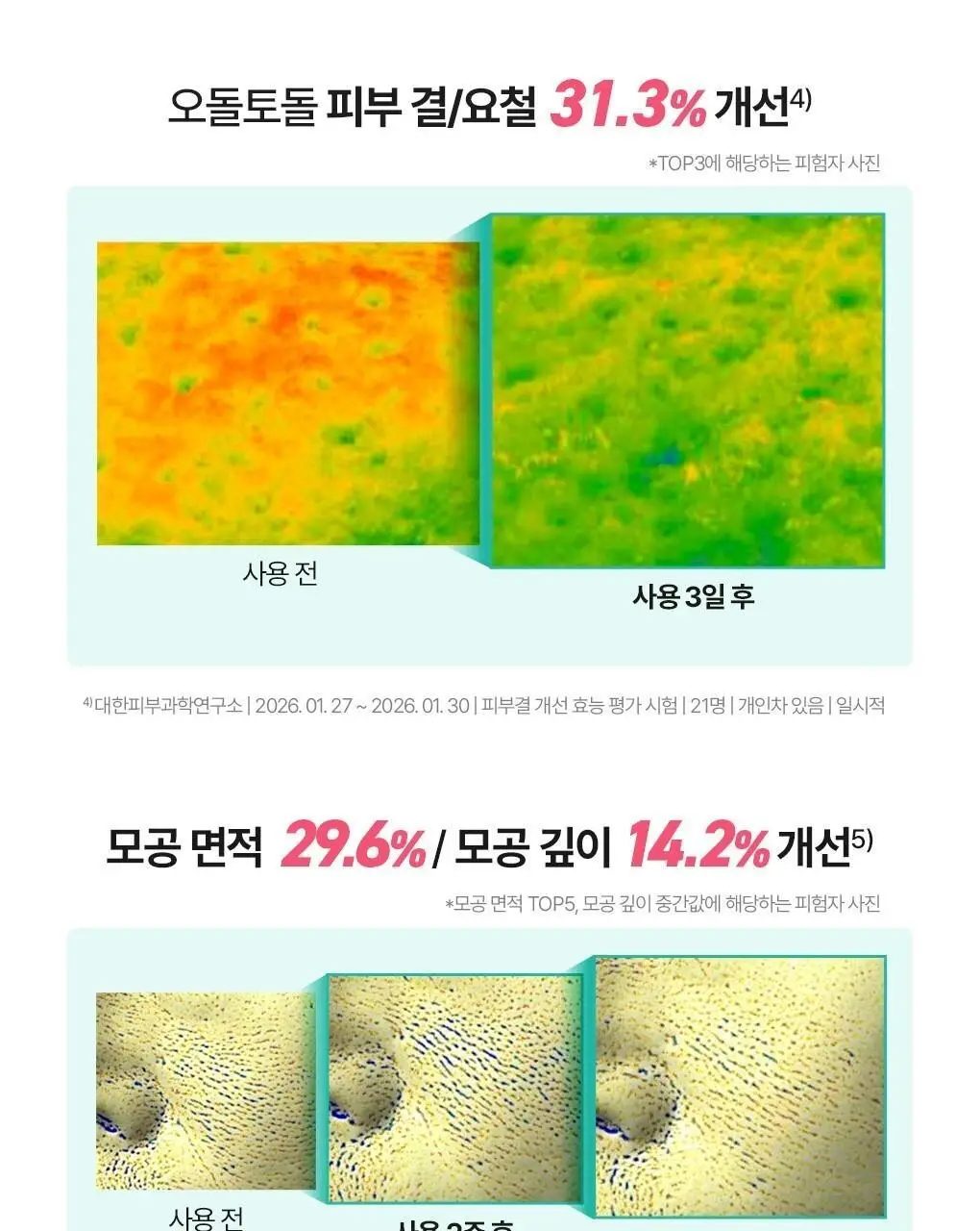 [가정의달특가] 브링그린 징크테카 리페어 흔적 크림 80ml (콜라보/기획) 상세페이지 30